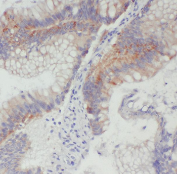 ENTR1 Rabbit Polyclonal Antibody
