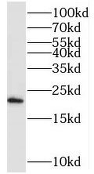 SEC11A Rabbit Polyclonal Antibody