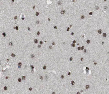 SEC13 Rabbit Polyclonal Antibody