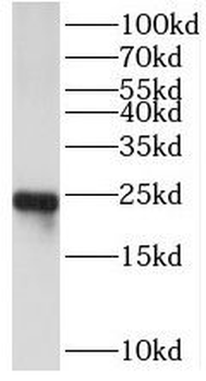 SEC22B Rabbit Polyclonal Antibody