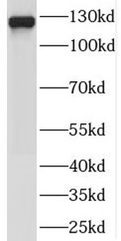 SEC23IP Rabbit Polyclonal Antibody