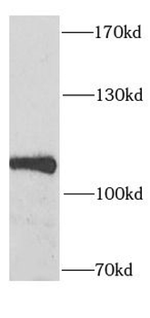 SECISBP2 Rabbit Polyclonal Antibody