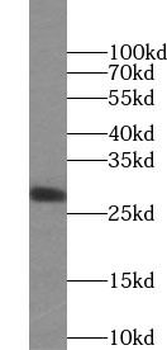 SECTM1 Mouse Monoclonal Antibody