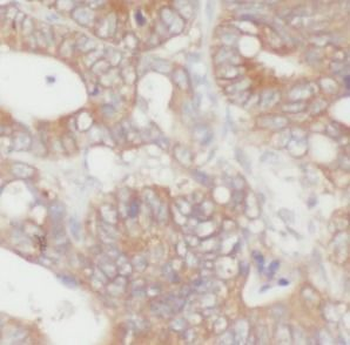 SECTM1 Mouse Monoclonal Antibody