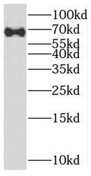 SEMA4F Rabbit Polyclonal Antibody