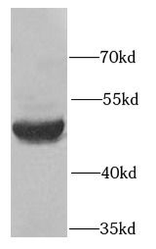 SERPINA10 Rabbit Polyclonal Antibody