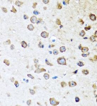 SERPINA10 Rabbit Polyclonal Antibody