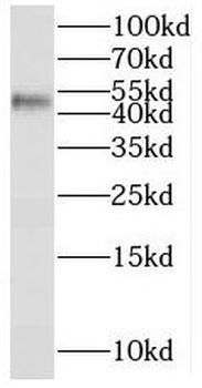 SERPINB2 Rabbit Polyclonal Antibody