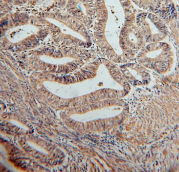 SERPINB2 Rabbit Polyclonal Antibody