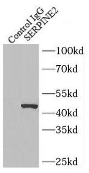 SERPINE2 Rabbit Polyclonal Antibody