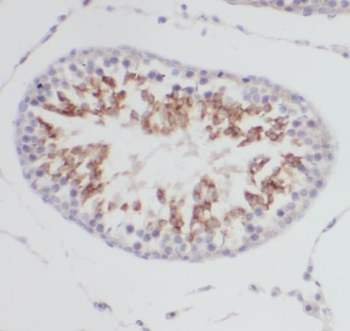 SERPINE2 Rabbit Polyclonal Antibody