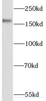 SETBP1 Rabbit Polyclonal Antibody