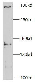 SETD2 Rabbit Polyclonal Antibody