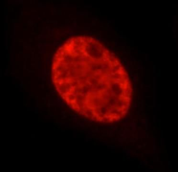 SETD2 Rabbit Polyclonal Antibody