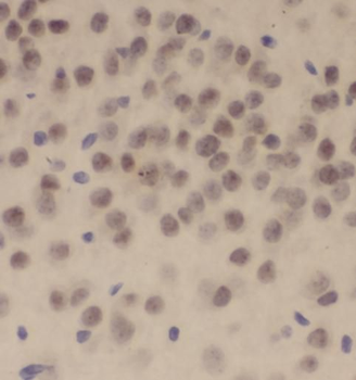 SETD2 Rabbit Polyclonal Antibody