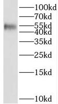 SETD6 Rabbit Polyclonal Antibody