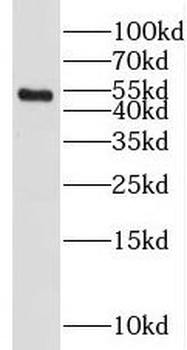 SETD7 Rabbit Polyclonal Antibody