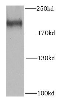 SETDB1 Rabbit Polyclonal Antibody