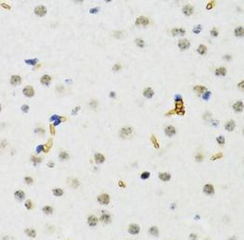 SETDB1 Rabbit Polyclonal Antibody