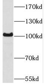 SETDB2 Rabbit Polyclonal Antibody