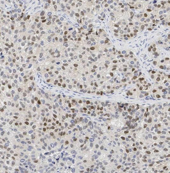 SF3A1 Rabbit Polyclonal Antibody