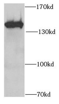 SF3B2 Rabbit Polyclonal Antibody