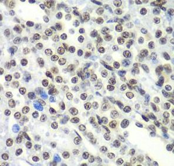 SF3B2 Rabbit Polyclonal Antibody