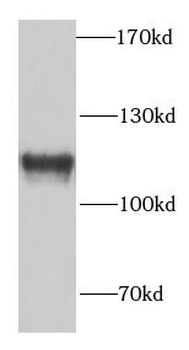 SFPQ Rabbit Polyclonal Antibody