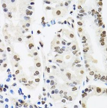 SFPQ Rabbit Polyclonal Antibody