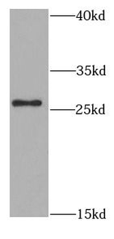 SFRP2 Rabbit Polyclonal Antibody