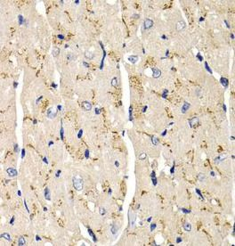 SFRP2 Rabbit Polyclonal Antibody