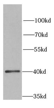 SFRP4 Rabbit Polyclonal Antibody