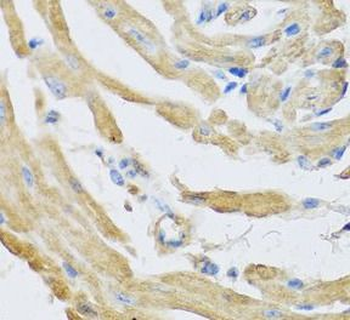 SFRP4 Rabbit Polyclonal Antibody