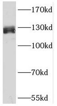 SUGP2 Rabbit Polyclonal Antibody