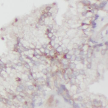 SUGP2 Rabbit Polyclonal Antibody