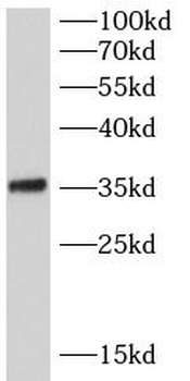 SRSF7 Rabbit Polyclonal Antibody