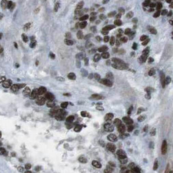 SRSF7 Rabbit Polyclonal Antibody