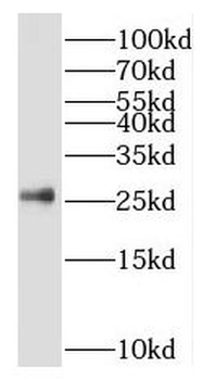SRSF9 Rabbit Polyclonal Antibody