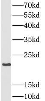SFTPC Rabbit Polyclonal Antibody
