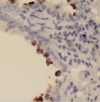 SFTPC Rabbit Polyclonal Antibody