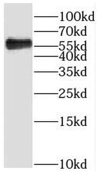 SGK3 Rabbit Polyclonal Antibody