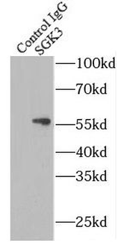 SGK3 Rabbit Polyclonal Antibody