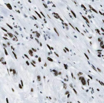SGK3 Rabbit Polyclonal Antibody
