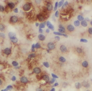 SGMS1 Rabbit Polyclonal Antibody