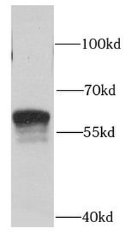 SGSH Rabbit Polyclonal Antibody