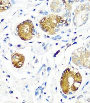 SGSH Rabbit Polyclonal Antibody