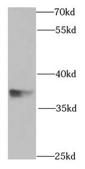 SGTA Rabbit Polyclonal Antibody