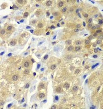 SGTA Rabbit Polyclonal Antibody