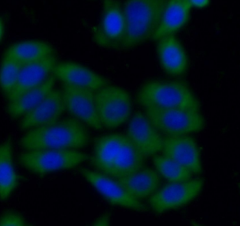 SH2B1 Rabbit Polyclonal Antibody