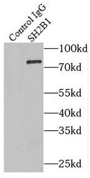 SH2B1 Rabbit Polyclonal Antibody